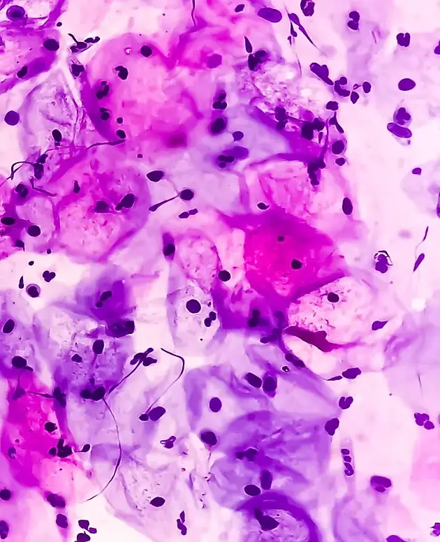 UCLA G.O. Discovery Lab